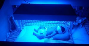 اجاره دستگاه زردی نوزاد