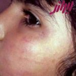 پیگیری کتک زدن کودک توسط دندانپزشک اصفهانی