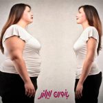 عوارض و انواع چاقی در زنان