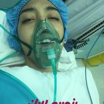 چهره کیمیا علیزاده بعد از عمل جراحی