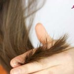 روشهای ساده درمان مو خوره